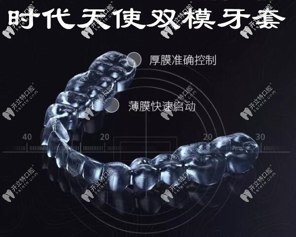 時代天使雙模牙套矯正虎牙 時代天使雙模牙套矯正虎牙