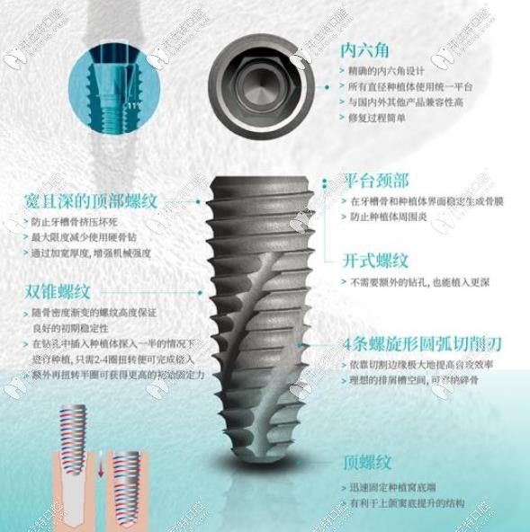 伊諾種植體優(yōu)勢(shì)