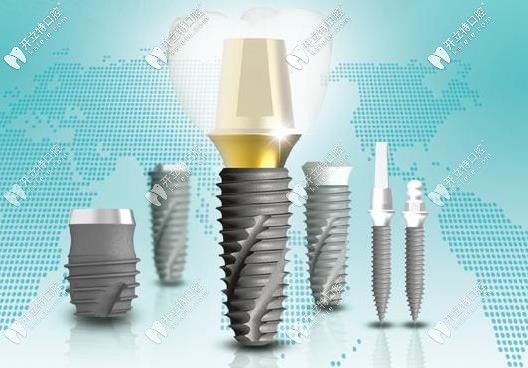 快戳本文了解關(guān)于韓國(guó)種植體中的伊諾inno種植牙的優(yōu)缺點(diǎn)吧