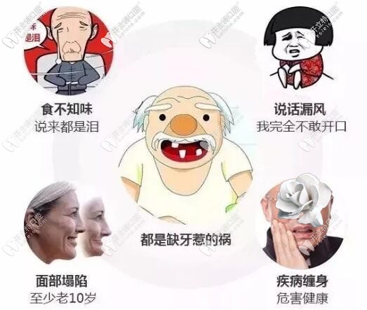 ?？邶埲A鼎點口腔劉文彤醫(yī)生介紹牙齒缺失的危害有哪些