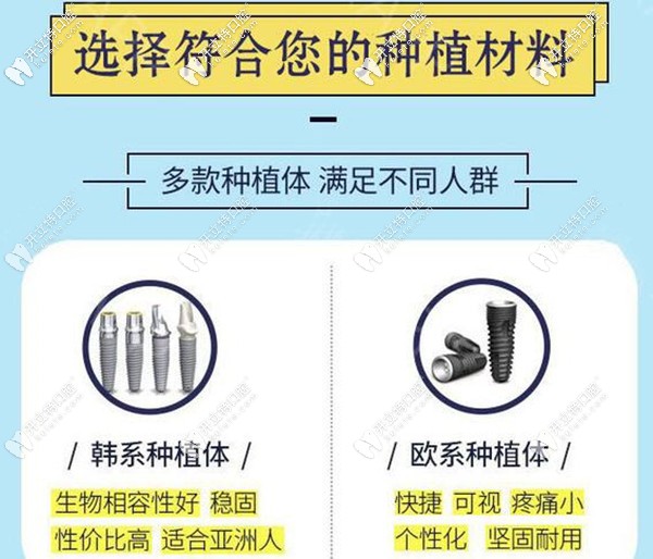 ?？诙c(diǎn)口腔韓系和歐系種植體