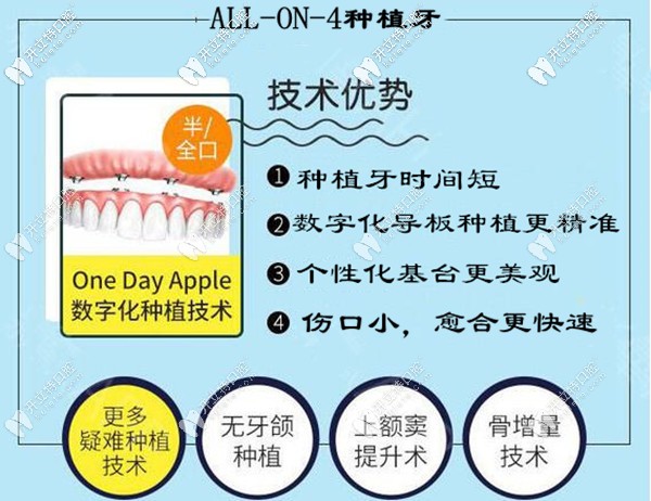 ?？诙c(diǎn)口腔allon4全口半口種植牙技術(shù)