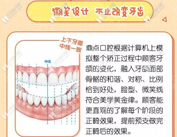 ?？诙c(diǎn)口腔牙齒矯正微笑設(shè)計(jì)