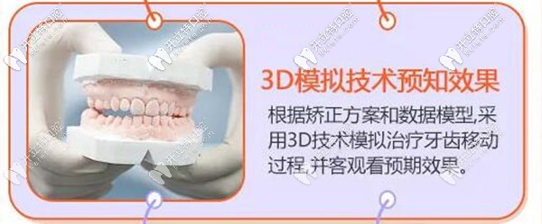 在?？诙c(diǎn)口腔做牙齒矯正前可先看效果