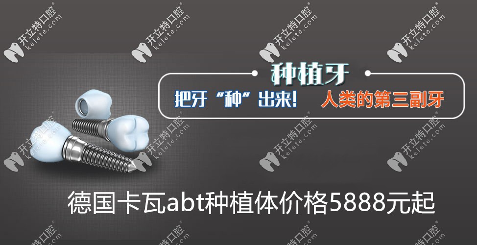 德國(guó)卡瓦abt種植牙價(jià)格