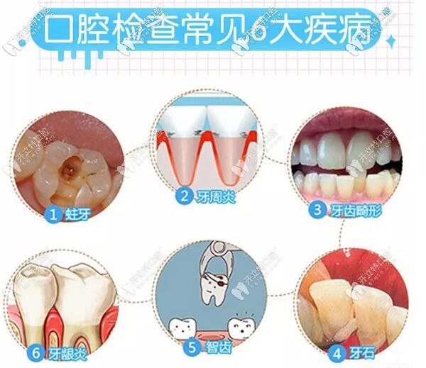 常見的口腔問題 常見的口腔問題