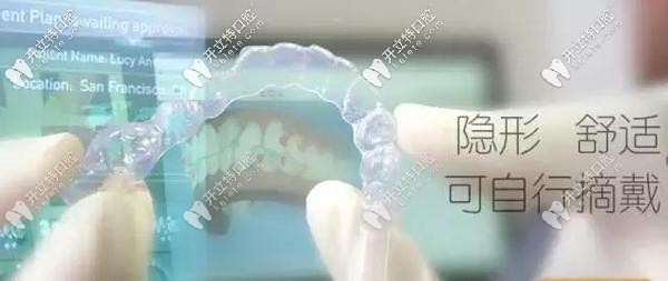 與傳統(tǒng)矯正相比隱形矯正有哪些優(yōu)勢？