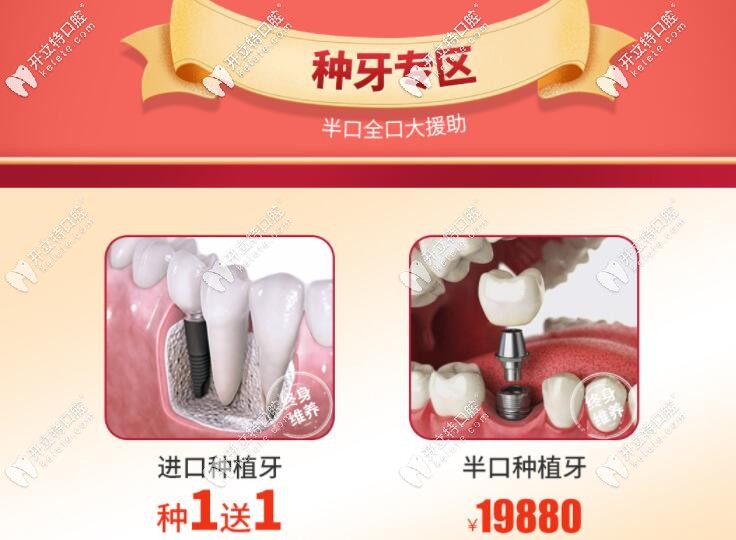 南寧柏樂口腔種植牙優(yōu)惠價格