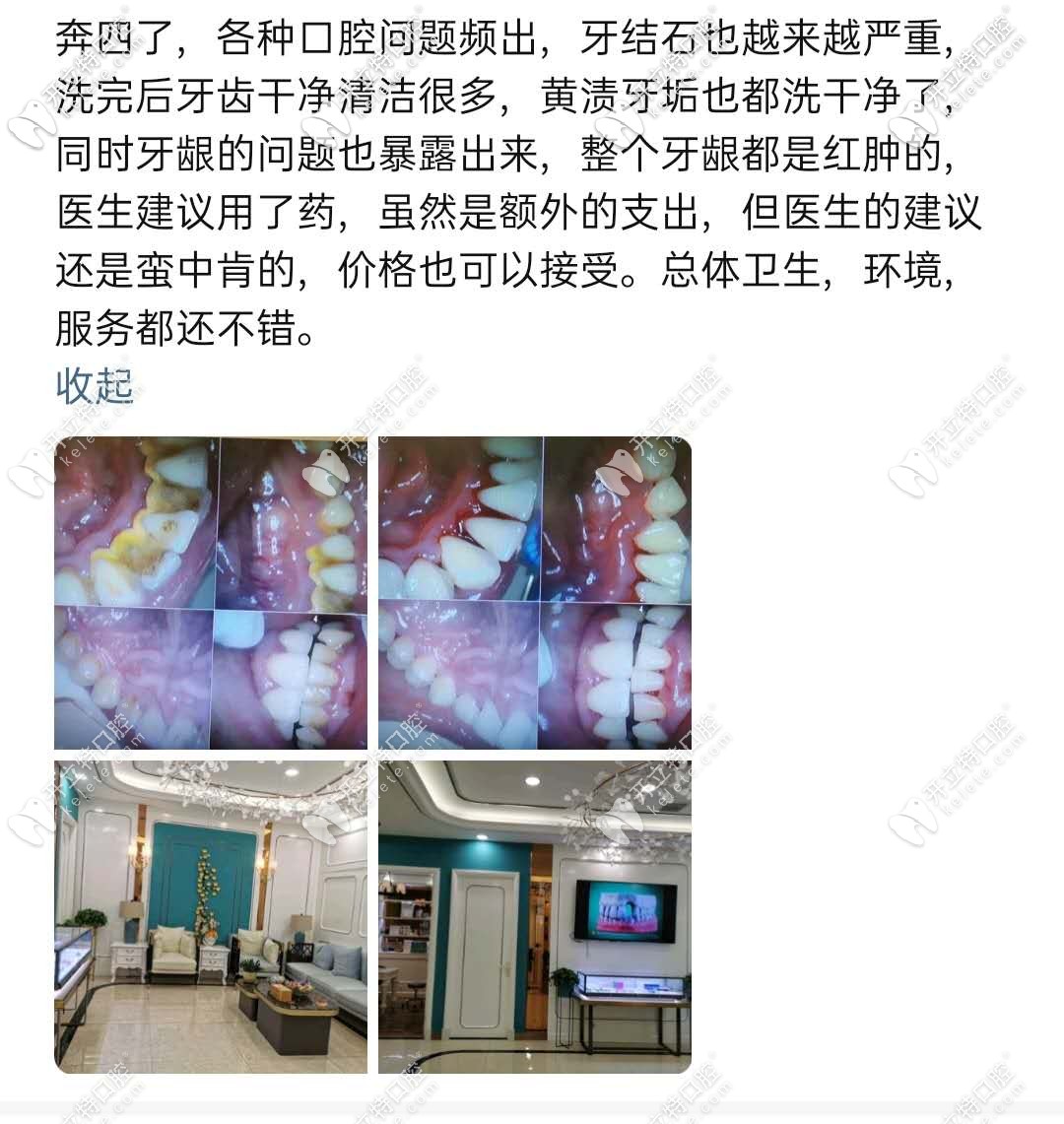 蘭州皓亞口腔點(diǎn)評