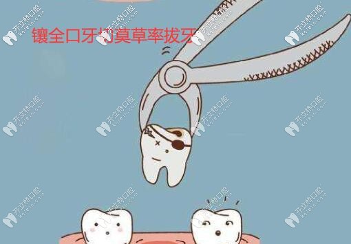 鑲牙必看!全口假牙需要把滿(mǎn)口殘余的牙齒及牙根全部拔掉嗎