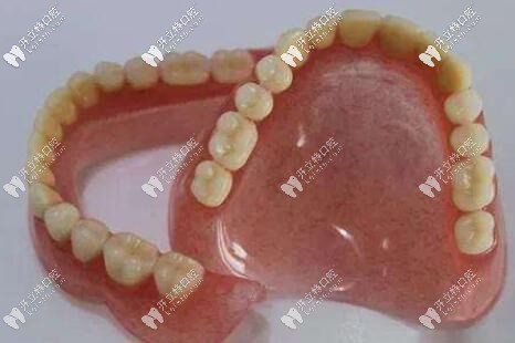 全口活動(dòng)假牙