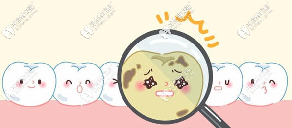兒童千萬不要補(bǔ)牙時謠言