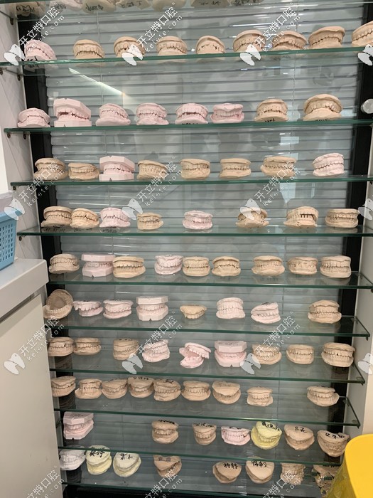 矯正時(shí)牙模的一角