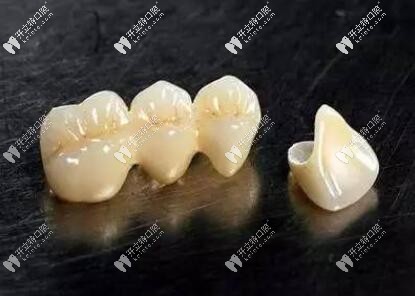 小診所愛(ài)爾創(chuàng)氧化鋯全瓷牙800一顆,你確定這是真的全瓷牙嗎