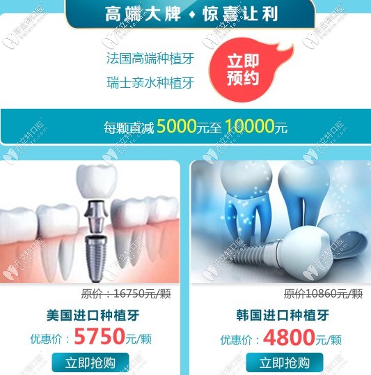 廣州廣大口腔醫(yī)院進(jìn)口種植牙活動(dòng)