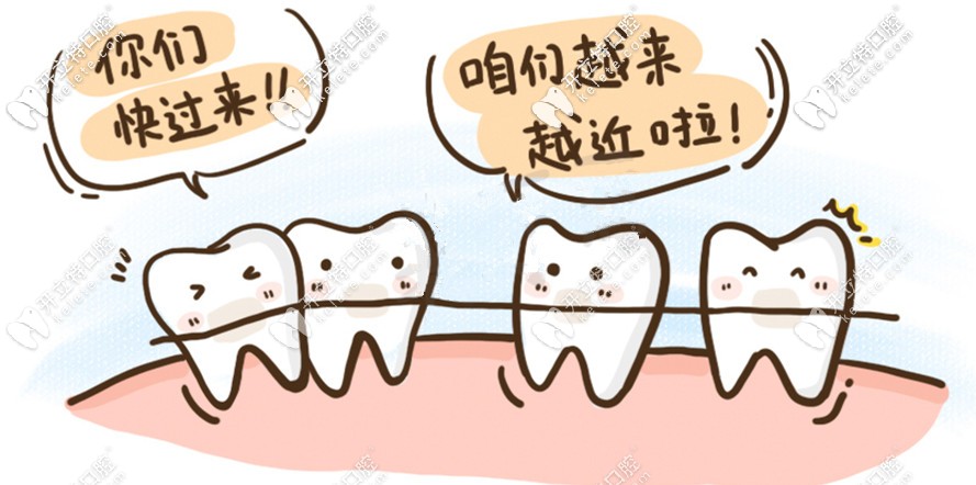 時代天使隱形矯正