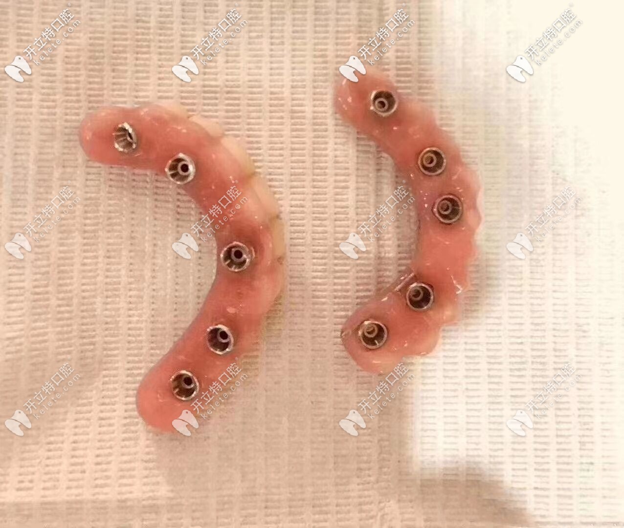 假牙圖片 假牙圖片