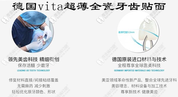 德國(guó)vita超薄瓷貼面不磨牙也不會(huì)脫落