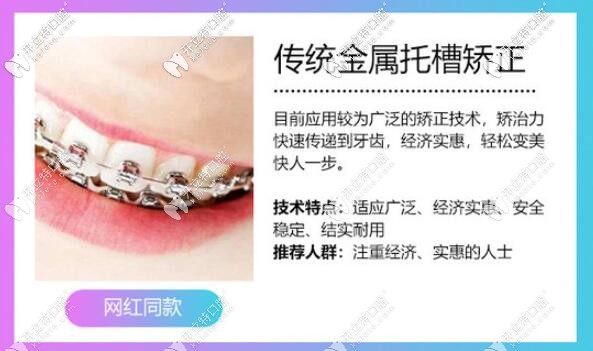 傳統(tǒng)金屬托槽矯正優(yōu)點