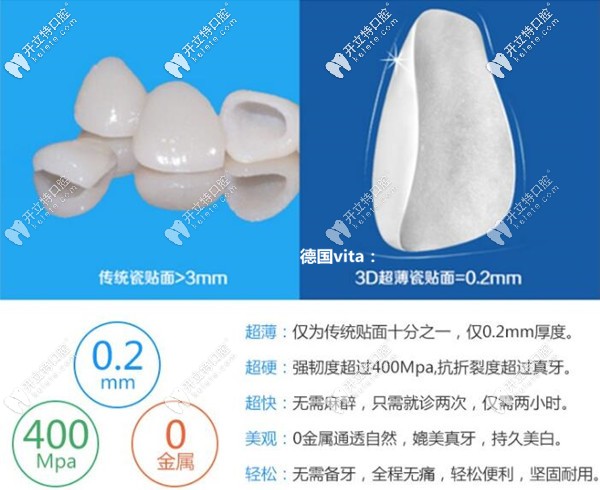 德國(guó)vita超薄玻璃陶瓷和琥珀瓷貼面價(jià)格的區(qū)別