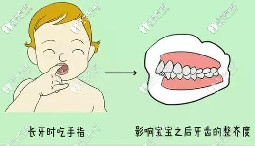 導致錯頜畸形的緣故 導致錯頜畸形的緣故
