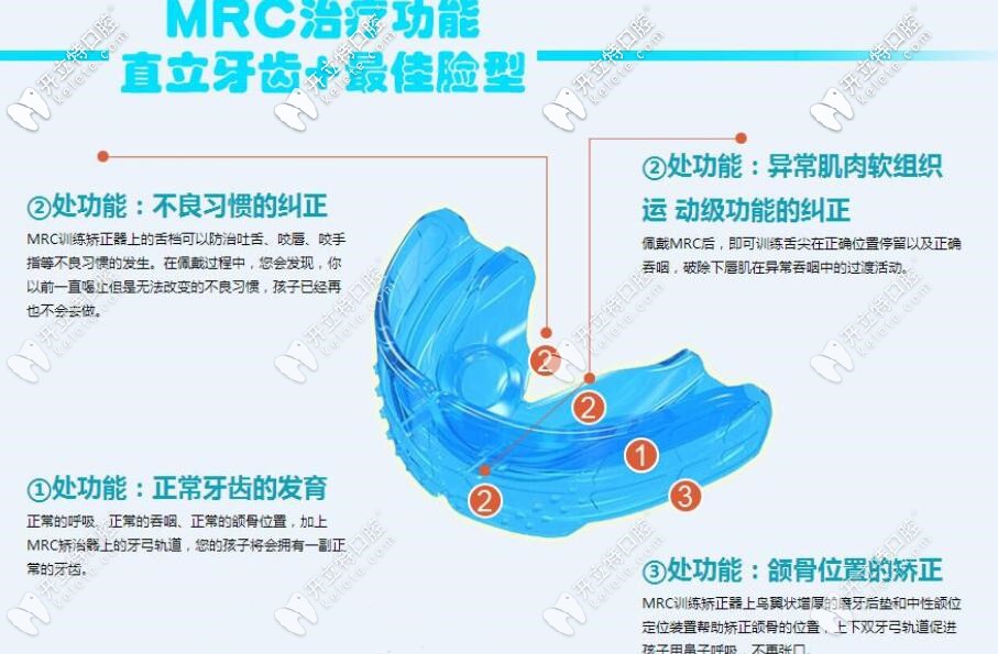孩子早期牙齒畸形可以用MRC進行干預(yù)矯正