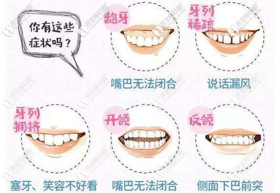 你的牙齒有這幾種情況嗎？