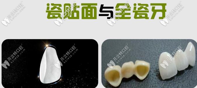 瓷貼面與全瓷牙如何選擇