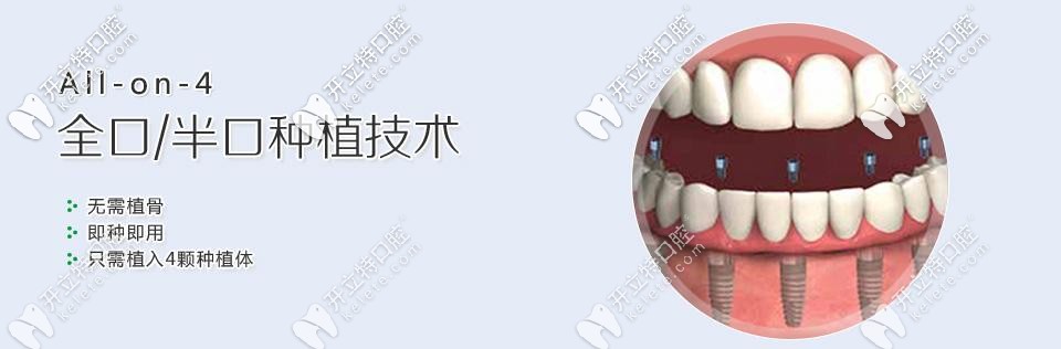 ALL-on-4種植牙優(yōu)勢(shì) ALL-on-4種植牙優(yōu)勢(shì)