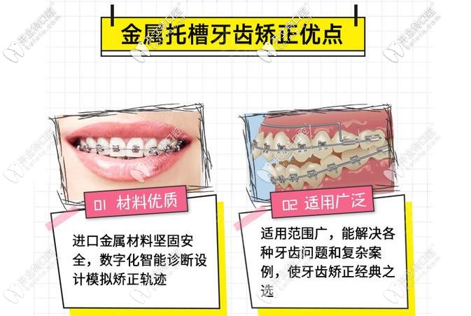 金屬矯正的優(yōu)勢(shì) 金屬矯正的優(yōu)勢(shì)