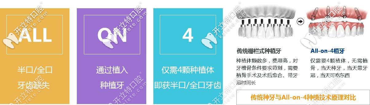 傳統(tǒng)種植牙和all-on-4的對(duì)比 傳統(tǒng)種植牙和all-on-4的對(duì)比