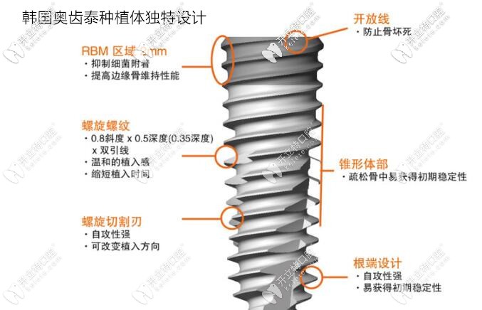 美國(guó)hiossen和韓國(guó)奧齒泰哪個(gè)更好