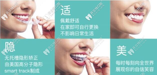 隱適美隱形矯正的優(yōu)勢(shì)