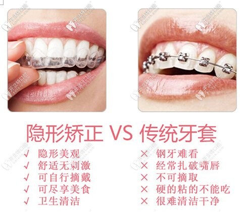 隱形矯正和傳統(tǒng)矯正的區(qū)對比圖