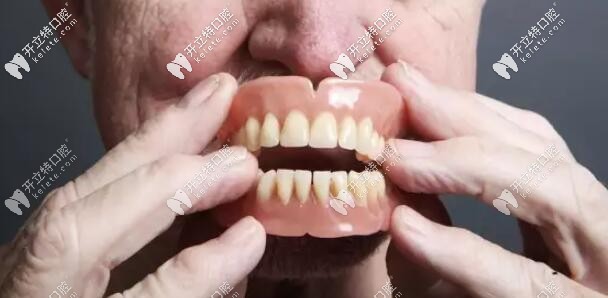 活動假牙圖片