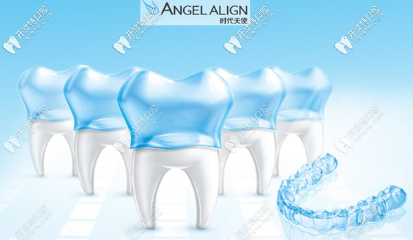 時代天使隱形矯正的價格只要13800元起