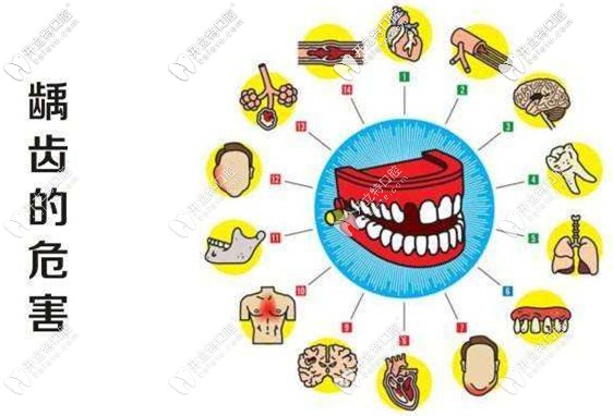齲齒自然也會(huì)影響兒童的牙齒