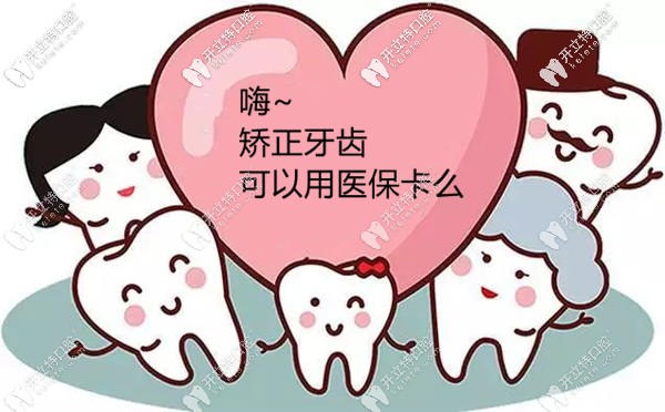 想趁暑期矯正牙齒,不知蘇州做牙齒矯正可以用醫(yī)保卡報銷嗎?