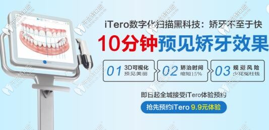矯正黑科技itero口掃價格 惠州致美口腔