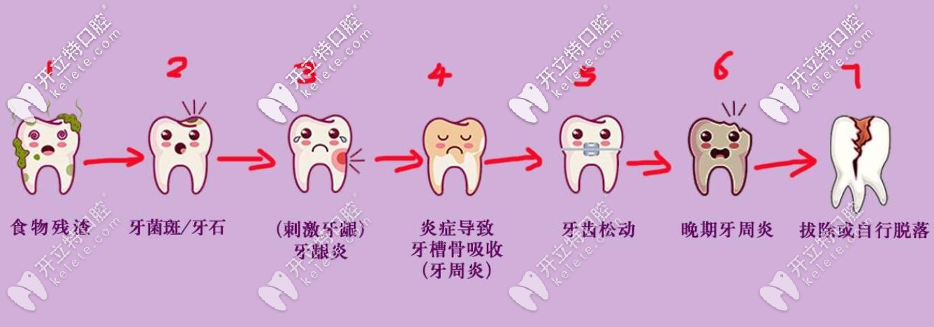 快看西安牙科收費價目表,那些牙疼拖延不看牙的人不淡定了
