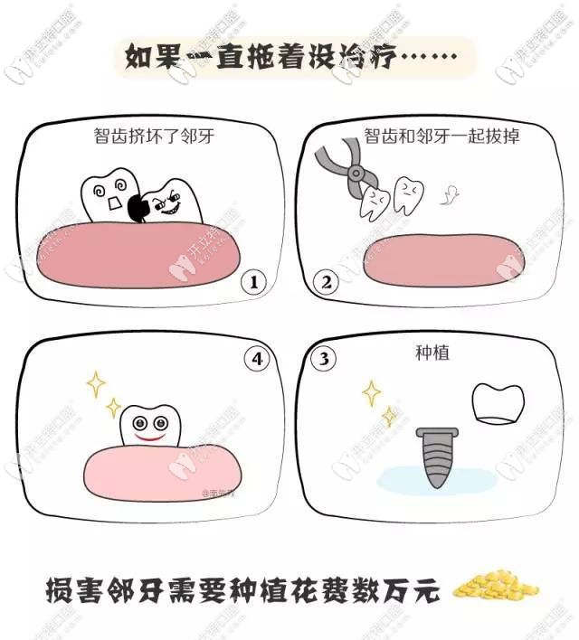 牙齒有問(wèn)題一定要及時(shí)治療哦