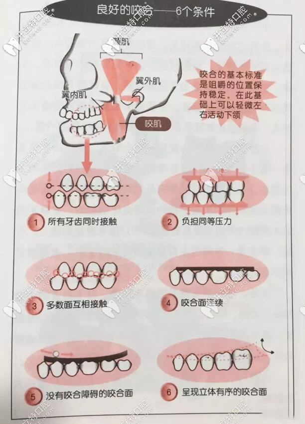 標(biāo)準(zhǔn)的牙齒咬合圖片