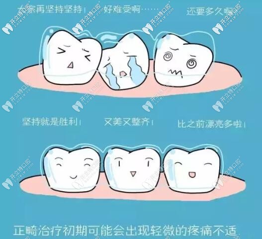牙齒矯正戴牙套為什么會(huì)疼痛