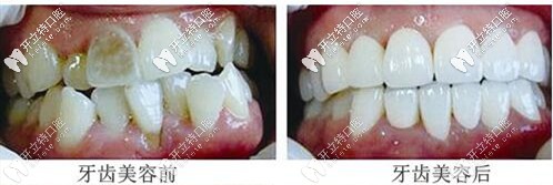沈陽百嘉麗口腔牙齒美容案例