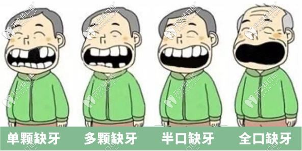 牙齒缺失了怎么辦