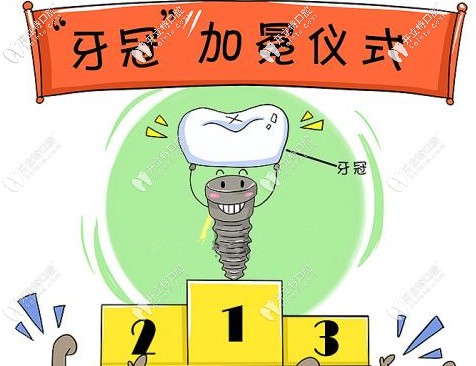 重慶做一顆牙冠的價格