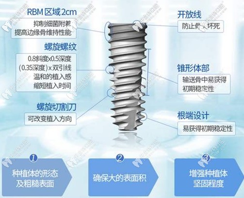 種植牙的特點