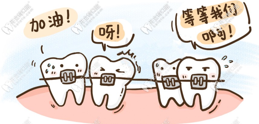 傳統(tǒng)金屬托槽矯正特價(jià)來(lái)襲