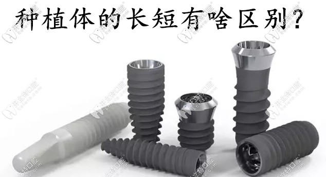 種植體的長(zhǎng)短有啥區(qū)別