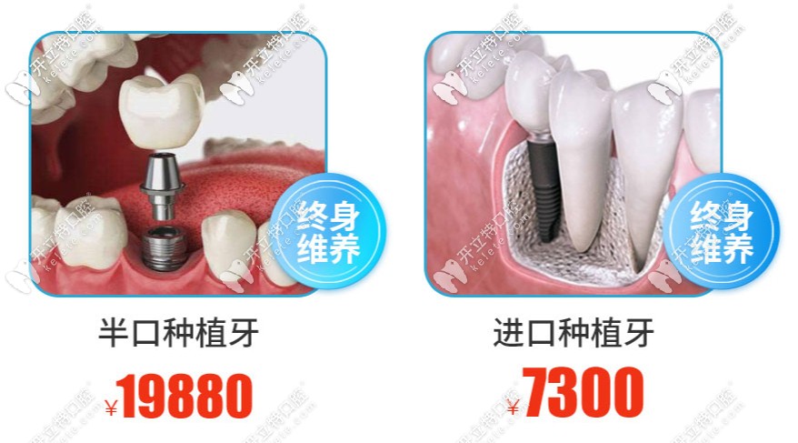 南寧柏樂(lè)口腔牙齒種植項(xiàng)目活動(dòng)